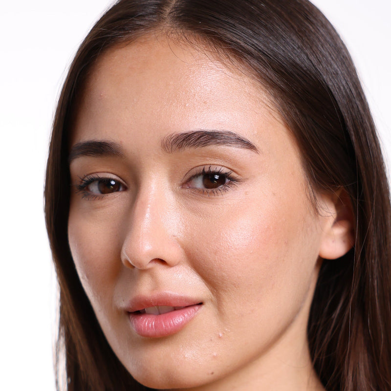 After 4 weeks of LED Light Therapy Treatment